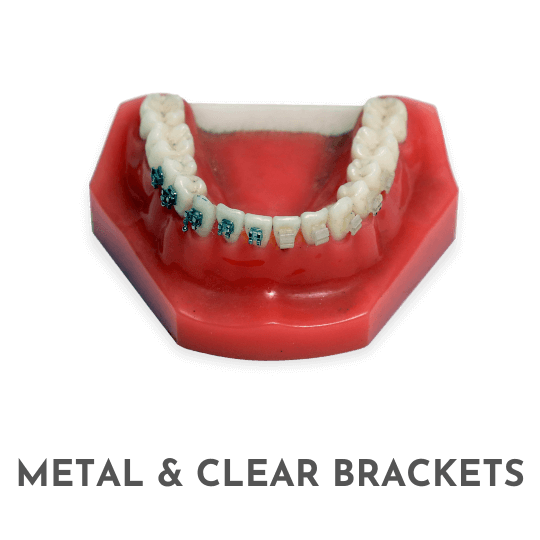 Metal and clear brackets 