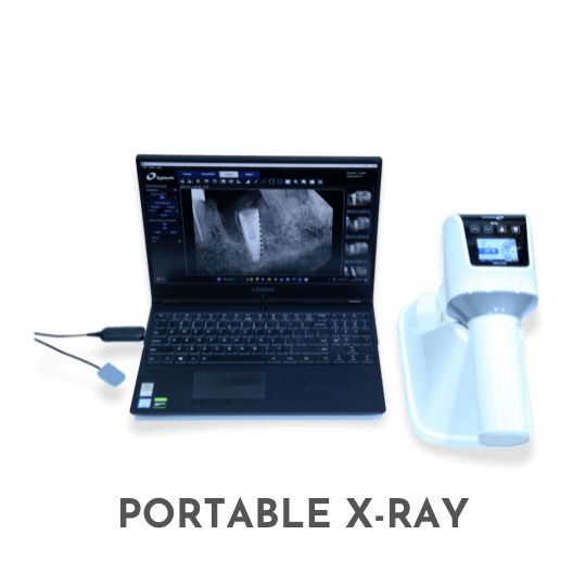 Poratble X - ray