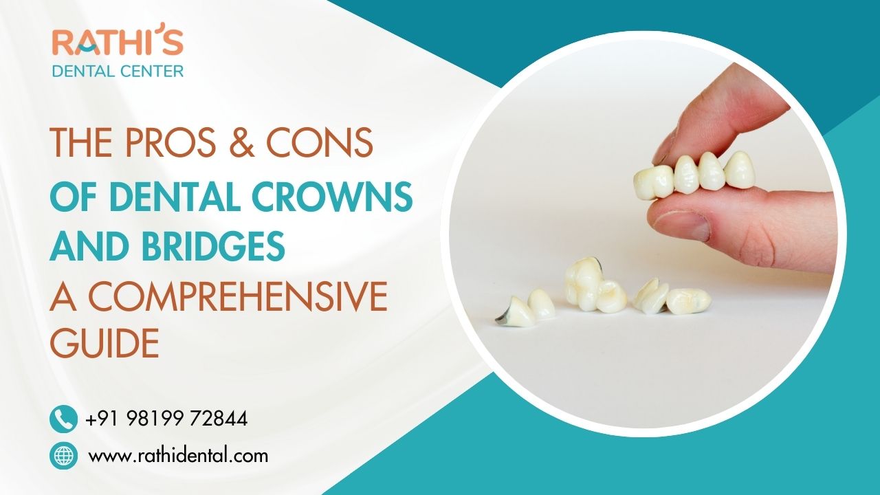 The Pros and Cons of Dental Crowns and Bridges: A Comprehensive Guide