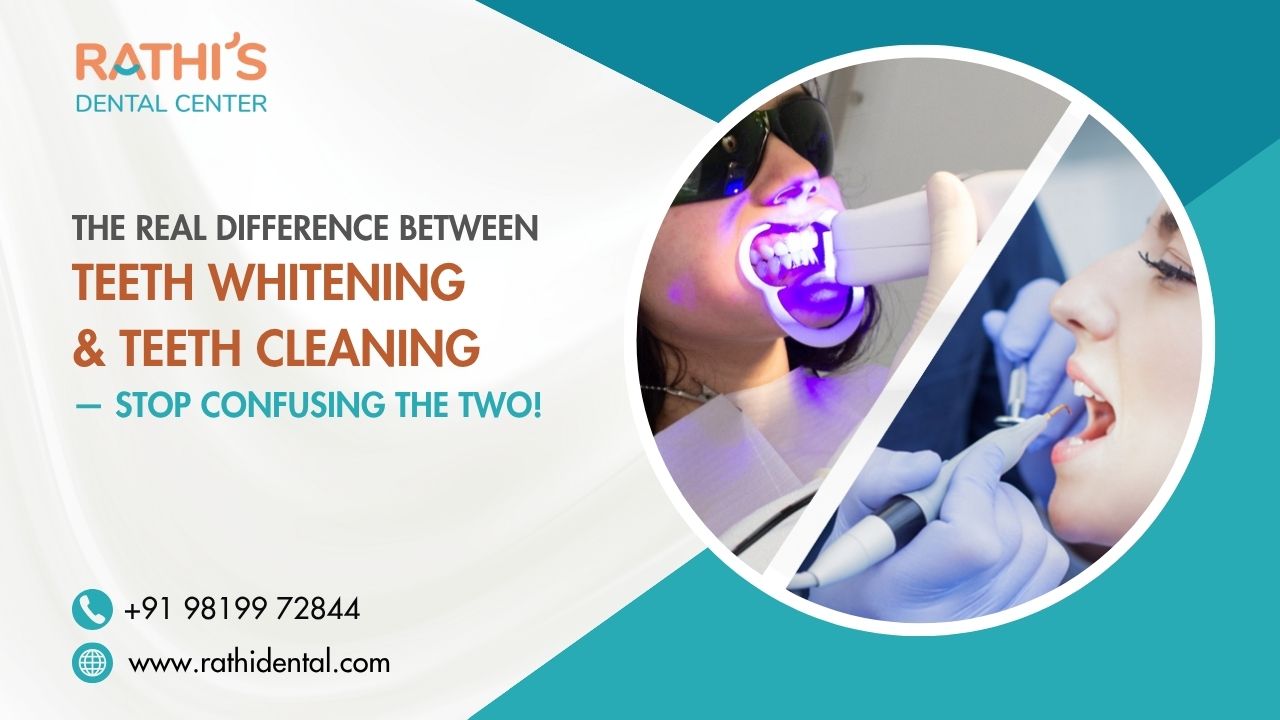The Real Difference Between Teeth Whitening and Teeth Cleaning — Stop ...