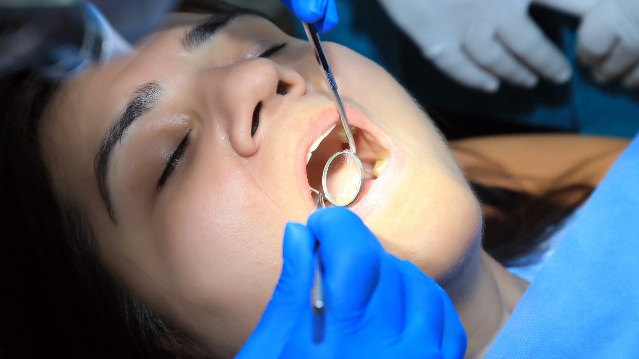 Tooth Cavity Filling